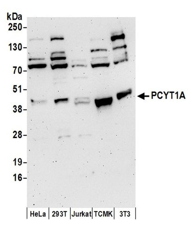 PCYT1A Antibody in Western Blot (WB)