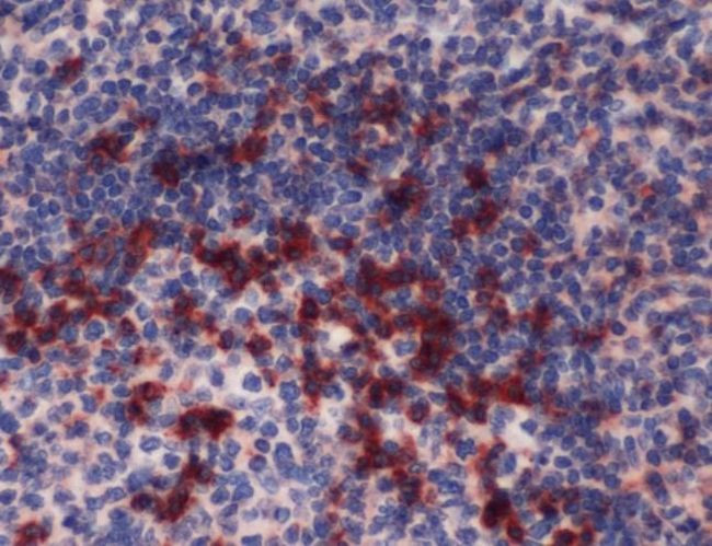 PD-1 Antibody in Immunohistochemistry (IHC)