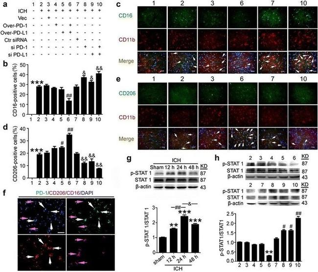 PD-1 Antibody in Immunohistochemistry (IHC)