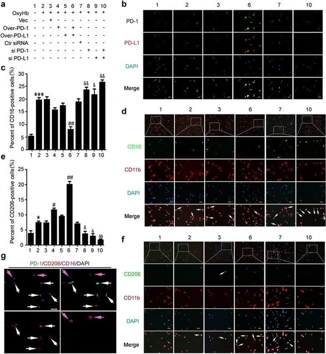 PD-1 Antibody in Immunohistochemistry (IHC)