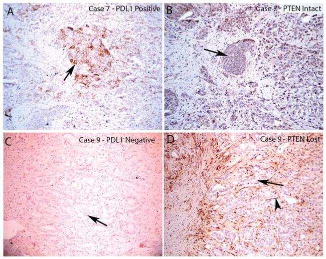 CD274 (PD-L1, B7-H1) Antibody in Immunohistochemistry (IHC)