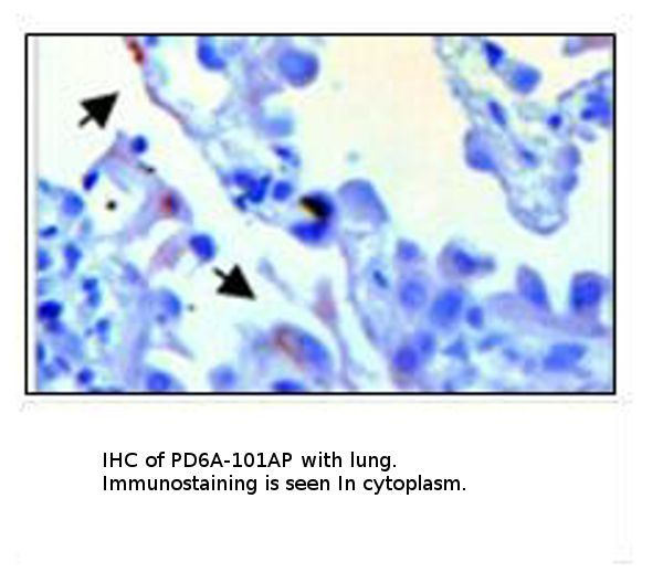 PDE6 Alpha Antibody in Immunohistochemistry (IHC)