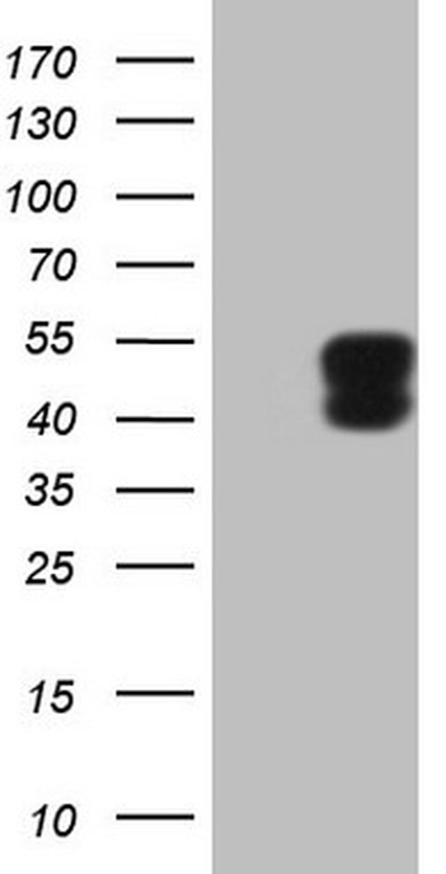 PDCD1 Antibody in Western Blot (WB)