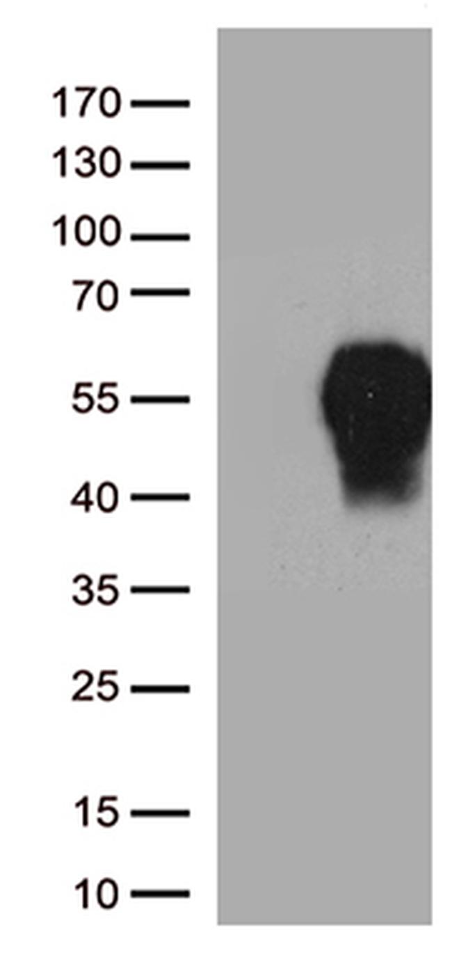 PDCD1 Antibody in Western Blot (WB)