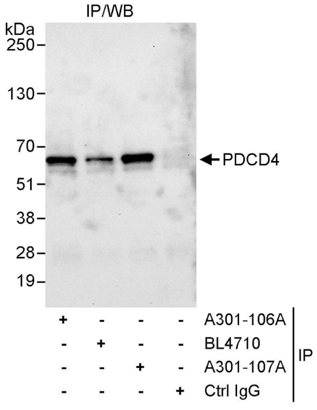 PDCD4 Antibody in Immunoprecipitation (IP)