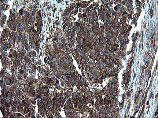 PDCD6IP Antibody in Immunohistochemistry (Paraffin) (IHC (P))