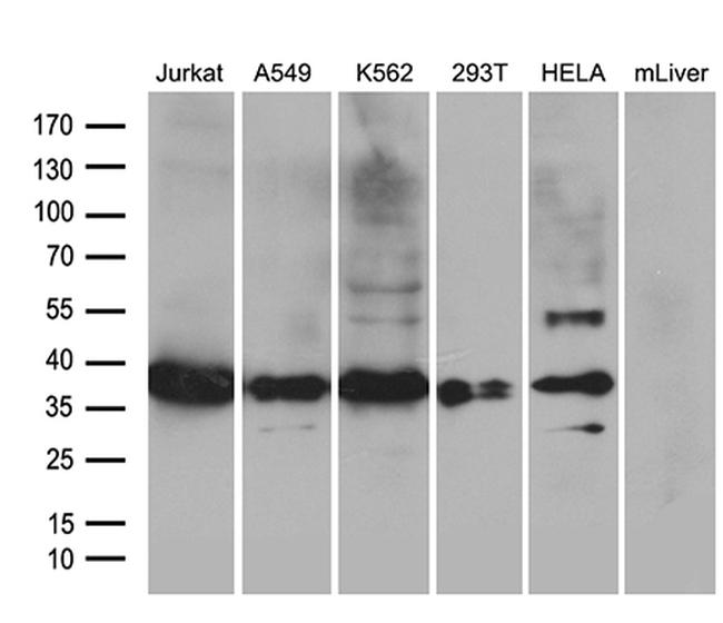 PDCL3 Antibody in Western Blot (WB)