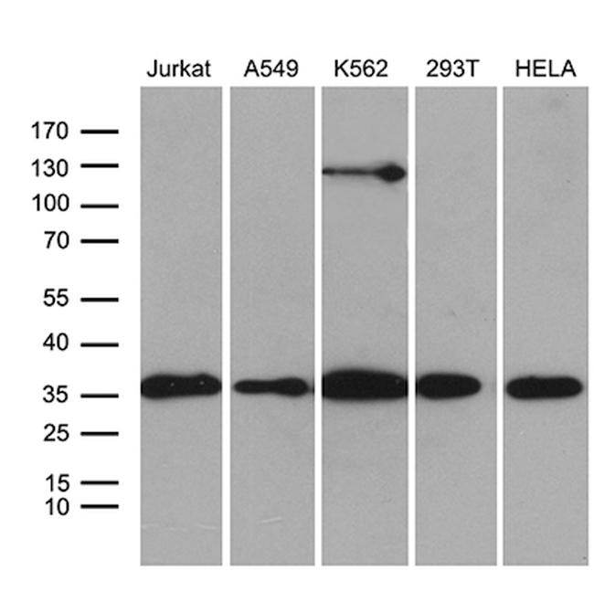 PDCL3 Antibody in Western Blot (WB)