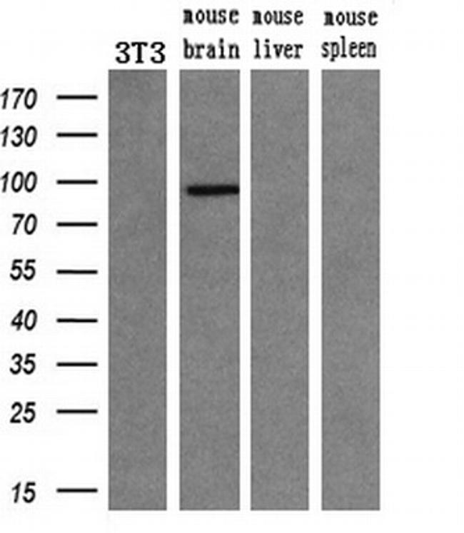 PDE10A Antibody in Western Blot (WB)