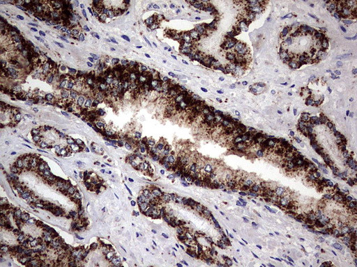 PDE1A Antibody in Immunohistochemistry (Paraffin) (IHC (P))