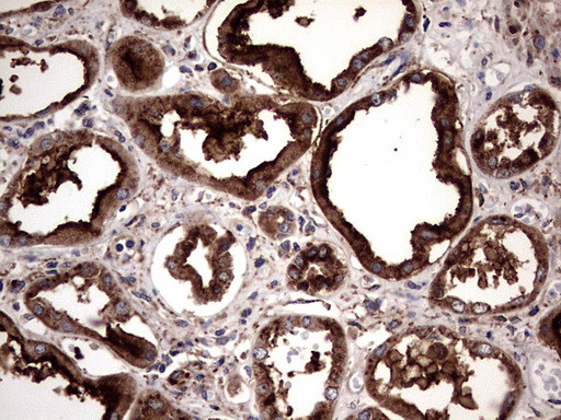 PDE1A Antibody in Immunohistochemistry (Paraffin) (IHC (P))