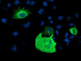 PDE1B Antibody in Immunocytochemistry (ICC/IF)