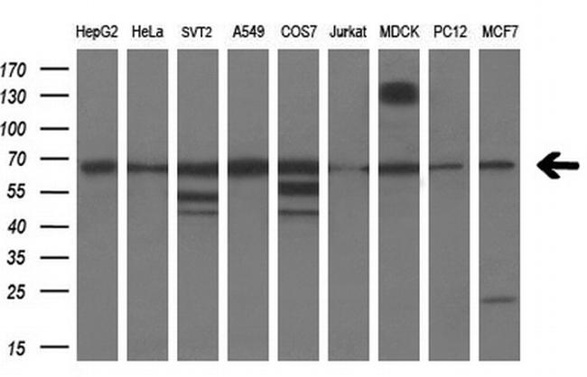 PDE1B Antibody in Western Blot (WB)
