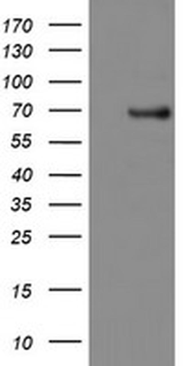 PDE1B Antibody in Western Blot (WB)