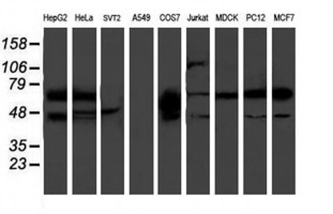 PDE1B Antibody in Western Blot (WB)