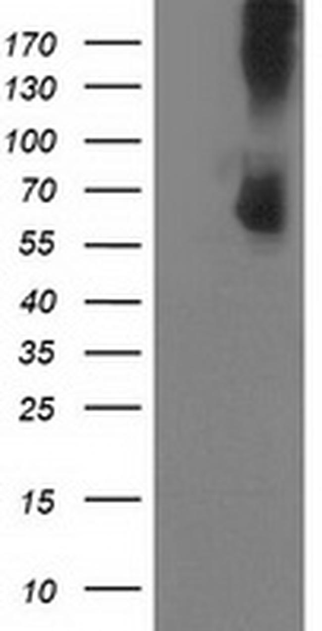 PDE1B Antibody in Western Blot (WB)