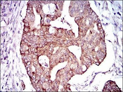 PDE1B Antibody in Immunohistochemistry (Paraffin) (IHC (P))