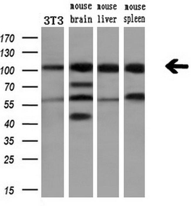 PDE2A Antibody in Western Blot (WB)