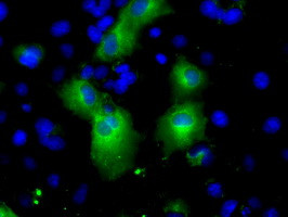 PDE4A Antibody in Immunocytochemistry (ICC/IF)