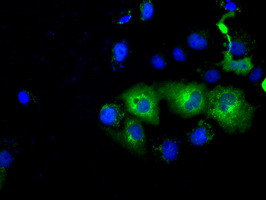 PDE4A Antibody in Immunocytochemistry (ICC/IF)