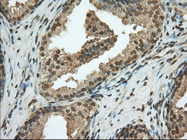 PDE4A Antibody in Immunohistochemistry (Paraffin) (IHC (P))