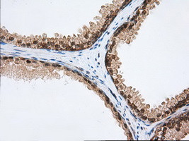 PDE4A Antibody in Immunohistochemistry (Paraffin) (IHC (P))