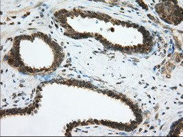 PDE4A Antibody in Immunohistochemistry (Paraffin) (IHC (P))