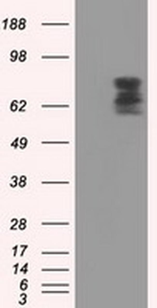 PDE4A Antibody in Western Blot (WB)