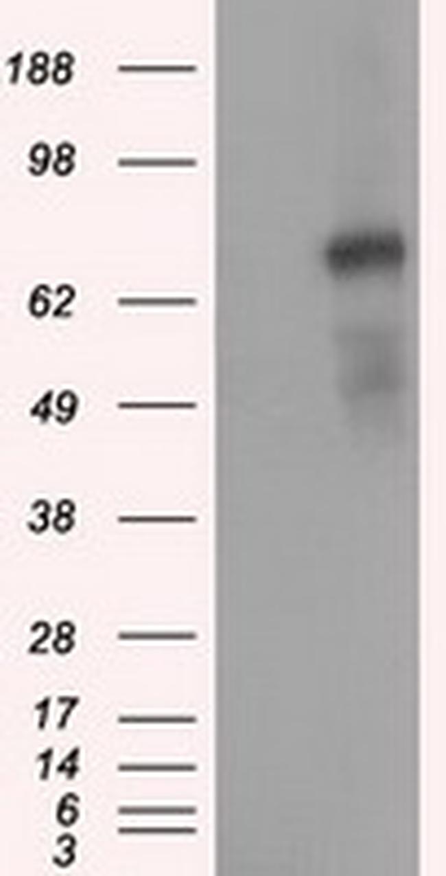 PDE4A Antibody in Western Blot (WB)