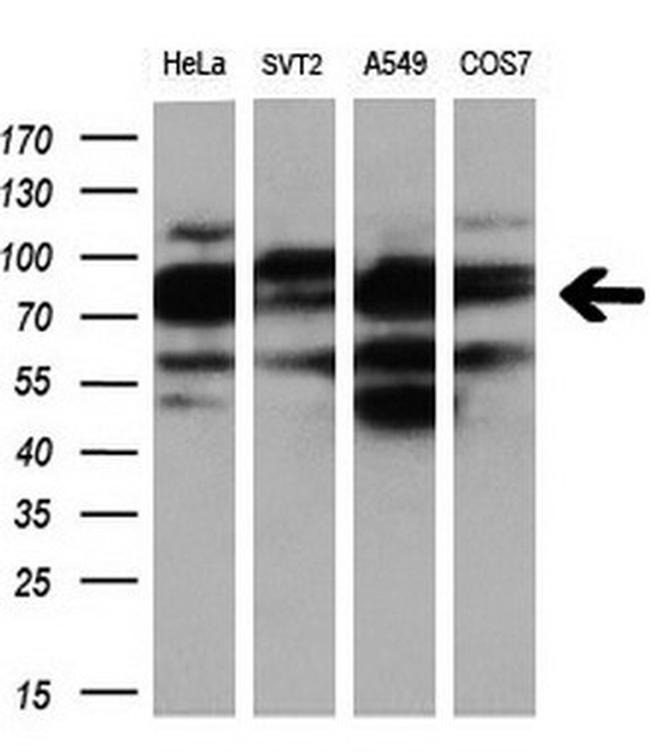 PDE4A Antibody in Western Blot (WB)