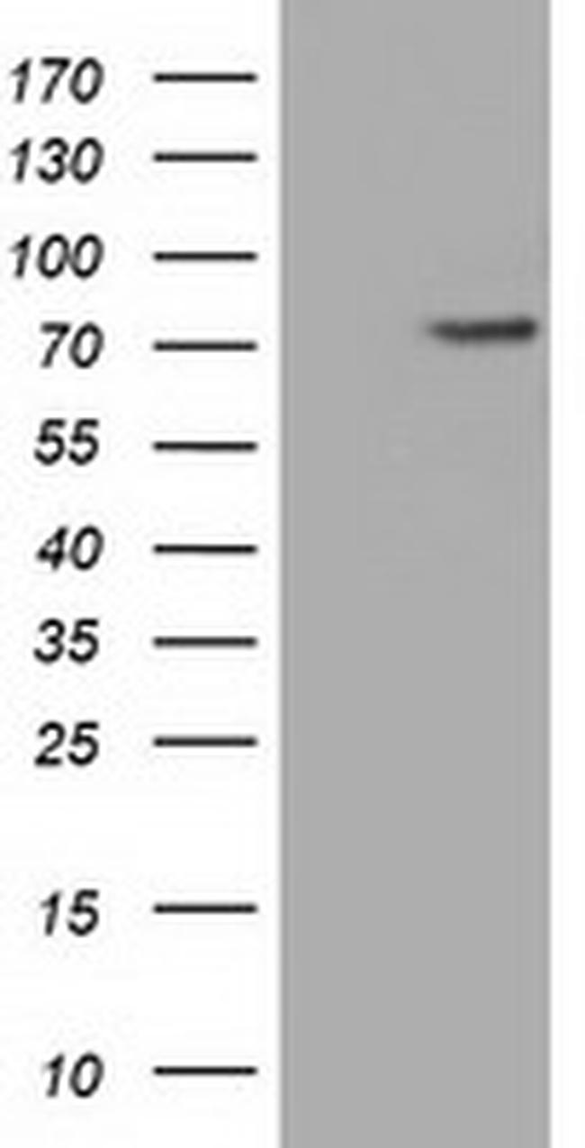 PDE4A Antibody in Western Blot (WB)