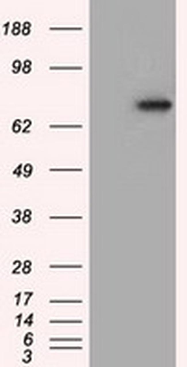 PDE4A Antibody in Western Blot (WB)