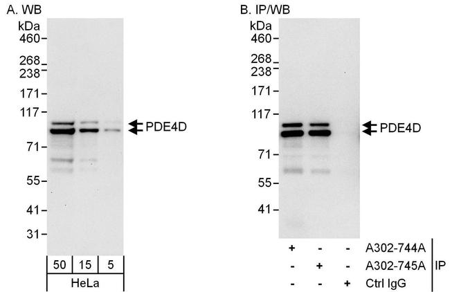 PDE4D Antibody in Western Blot (WB)