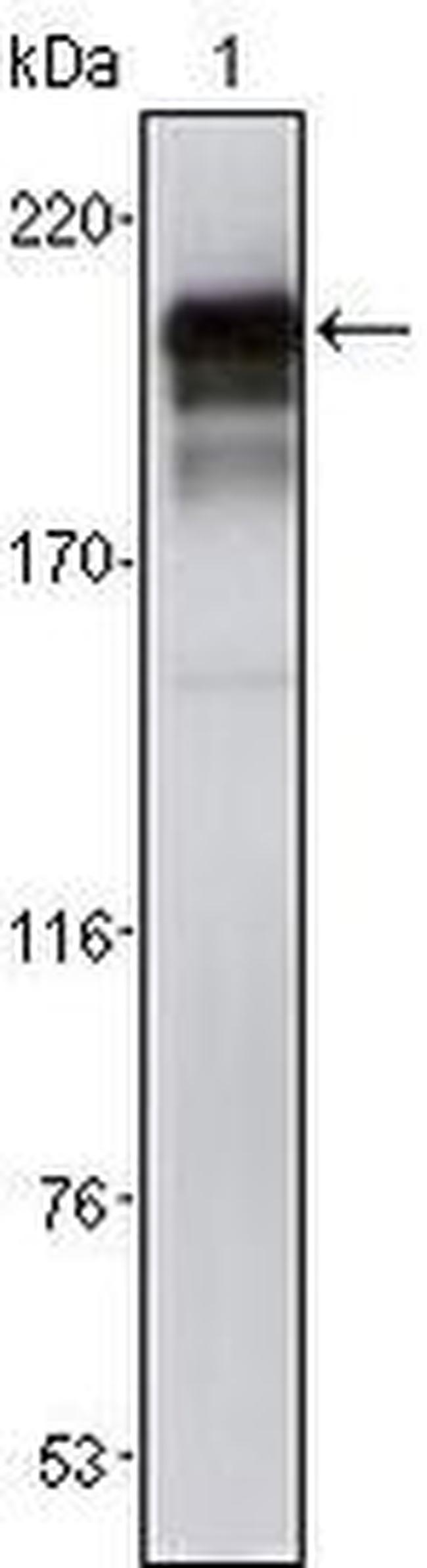 PDGFRB Antibody in Western Blot (WB)