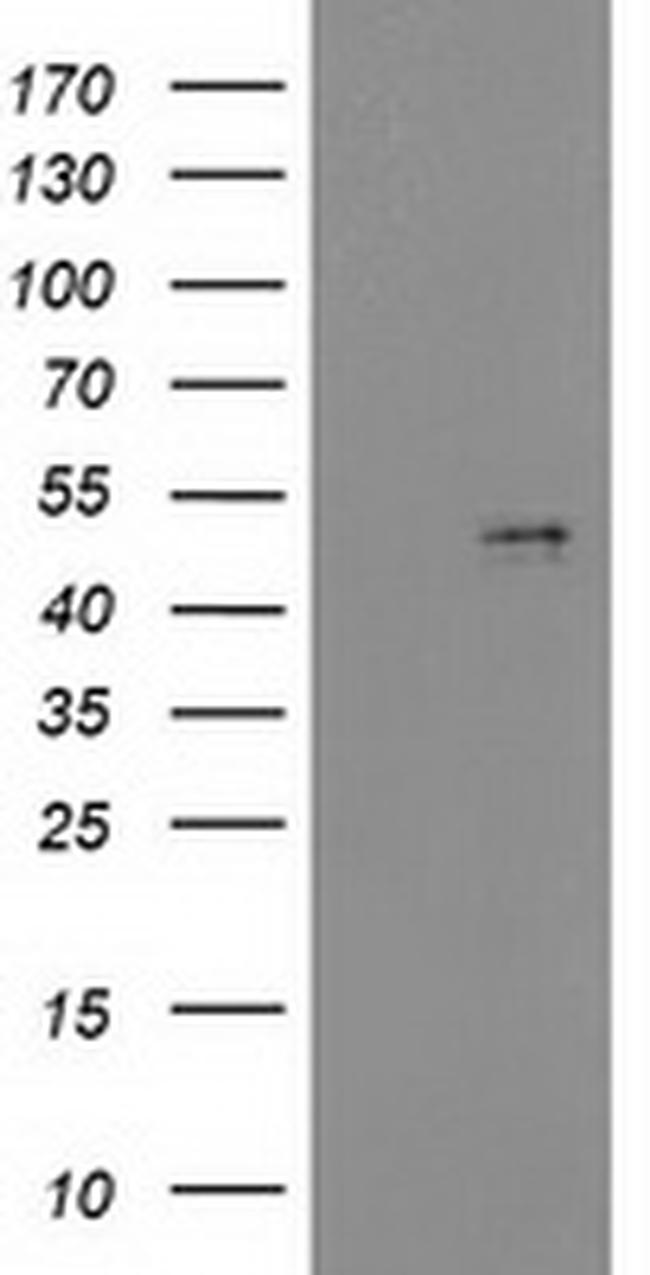 PDGFD Antibody in Western Blot (WB)