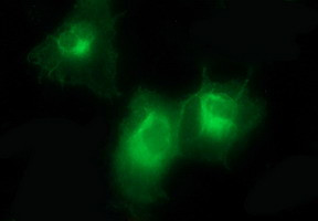 PDGFRB Antibody in Immunocytochemistry (ICC/IF)