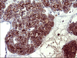 PDGFRB Antibody in Immunohistochemistry (Paraffin) (IHC (P))