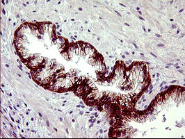 PDGFRB Antibody in Immunohistochemistry (Paraffin) (IHC (P))