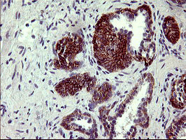 PDGFRB Antibody in Immunohistochemistry (Paraffin) (IHC (P))