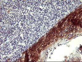 PDGFRB Antibody in Immunohistochemistry (Paraffin) (IHC (P))