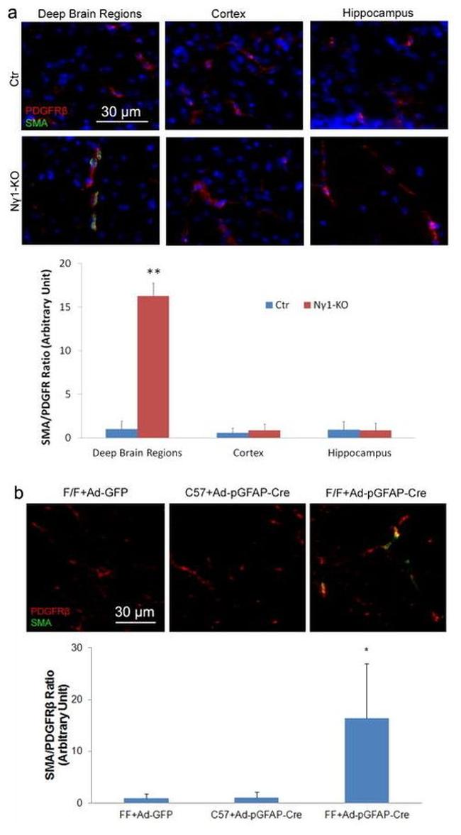 CD140b (PDGFRB) Antibody in Immunohistochemistry (IHC)