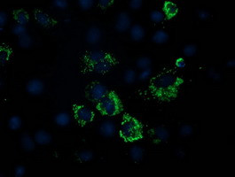 PDHA1 Antibody in Immunocytochemistry (ICC/IF)