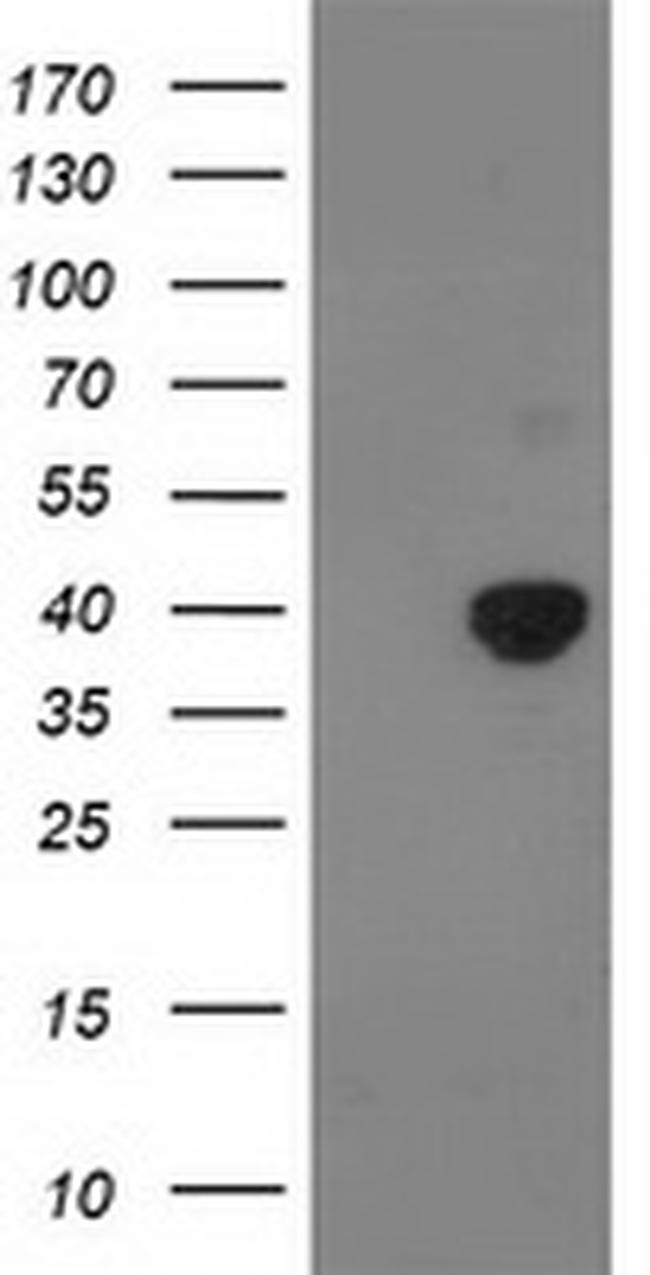 PDHA1 Antibody in Western Blot (WB)