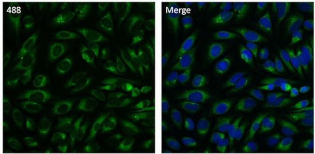 PDI Antibody in Immunocytochemistry (ICC/IF)