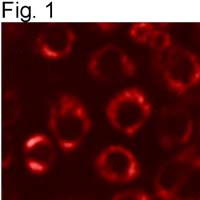 PDI Antibody in Immunocytochemistry (ICC/IF)