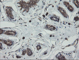 PDIA3 Antibody in Immunohistochemistry (Paraffin) (IHC (P))