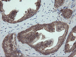 PDIA3 Antibody in Immunohistochemistry (Paraffin) (IHC (P))