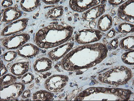 PDIA3 Antibody in Immunohistochemistry (Paraffin) (IHC (P))