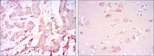 PDK1 Antibody in Immunohistochemistry (Paraffin) (IHC (P))