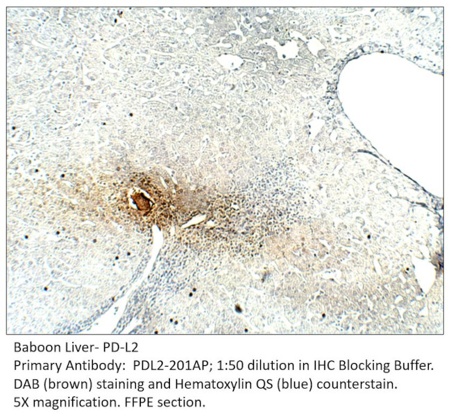 PD-L2 Antibody in Immunohistochemistry (IHC)